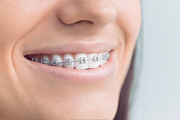 Best Traditional Braces  in Devine, TX